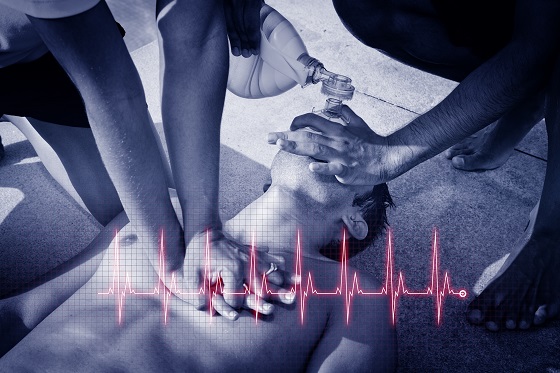 Cardiopulmonary Resuscitation (CPR) To A Drowned Man. Graphic Da