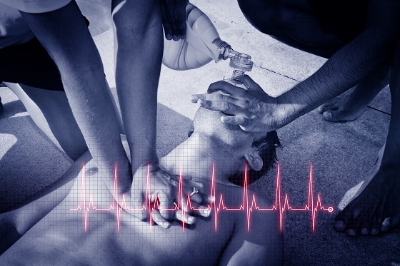 Cardiopulmonary Resuscitation (CPR)To A Drowned Man. Graphic Da
